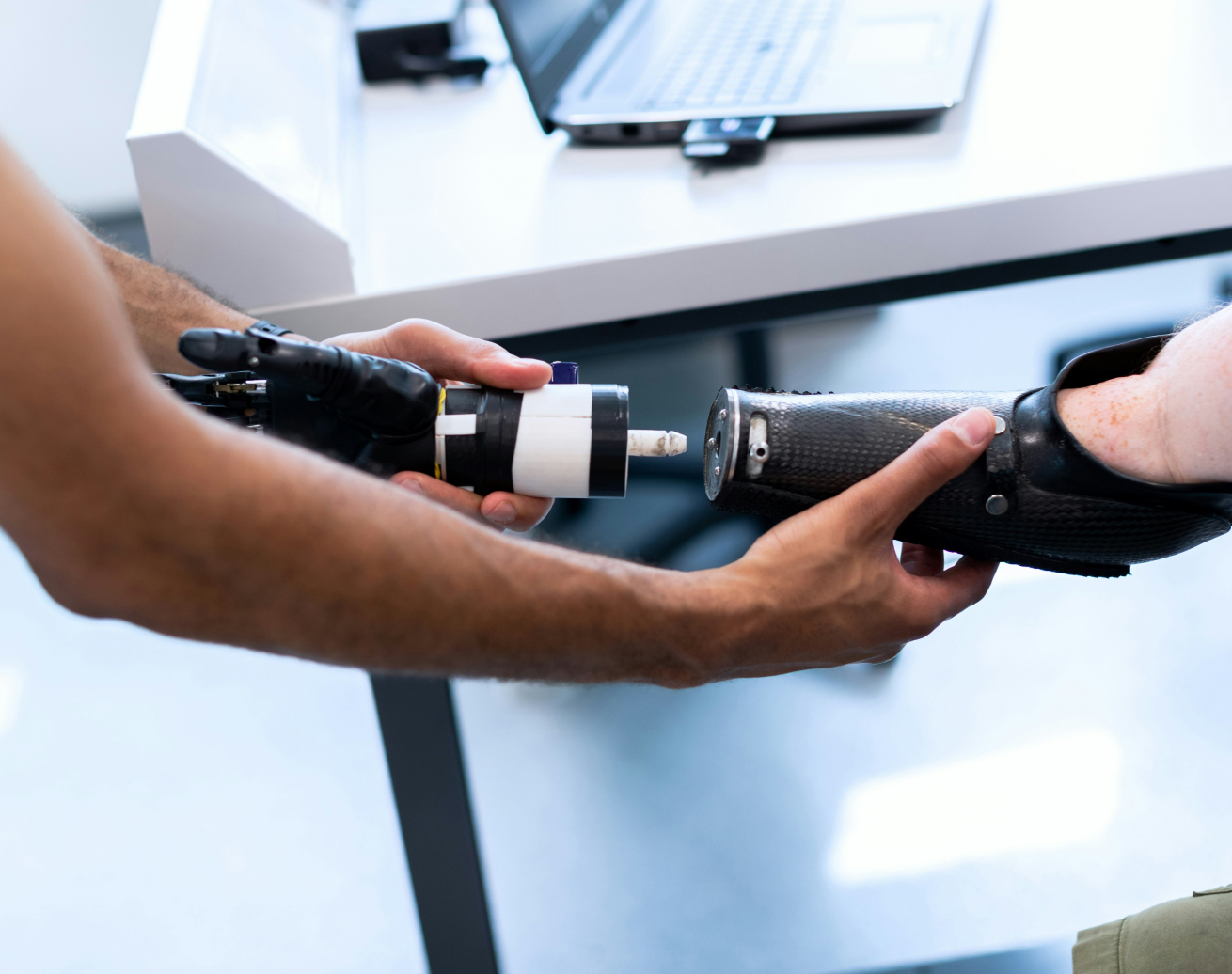 Technician fitting a prosthetic arm connector into a carbon fibre prosthetic leg socket during adjustment.